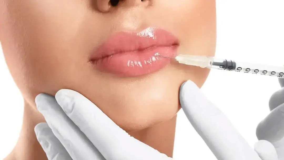 Aumento de labios: ¿En qué consiste?
