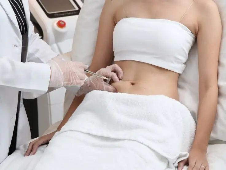 Carboxiterapia