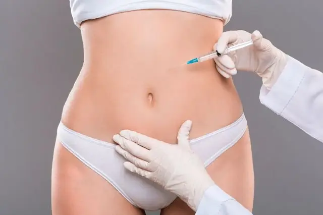 Carboxiterapia