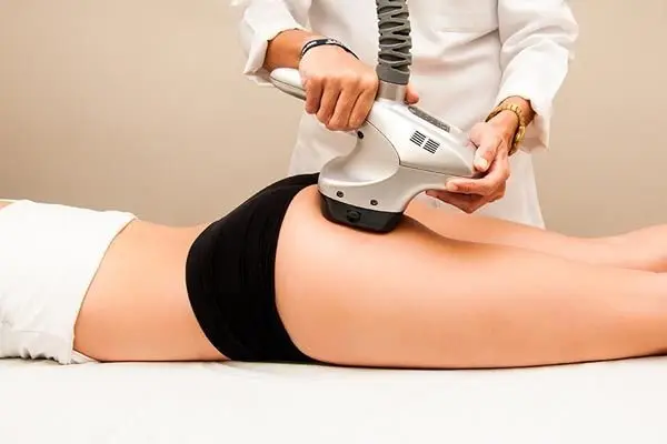 Preparación