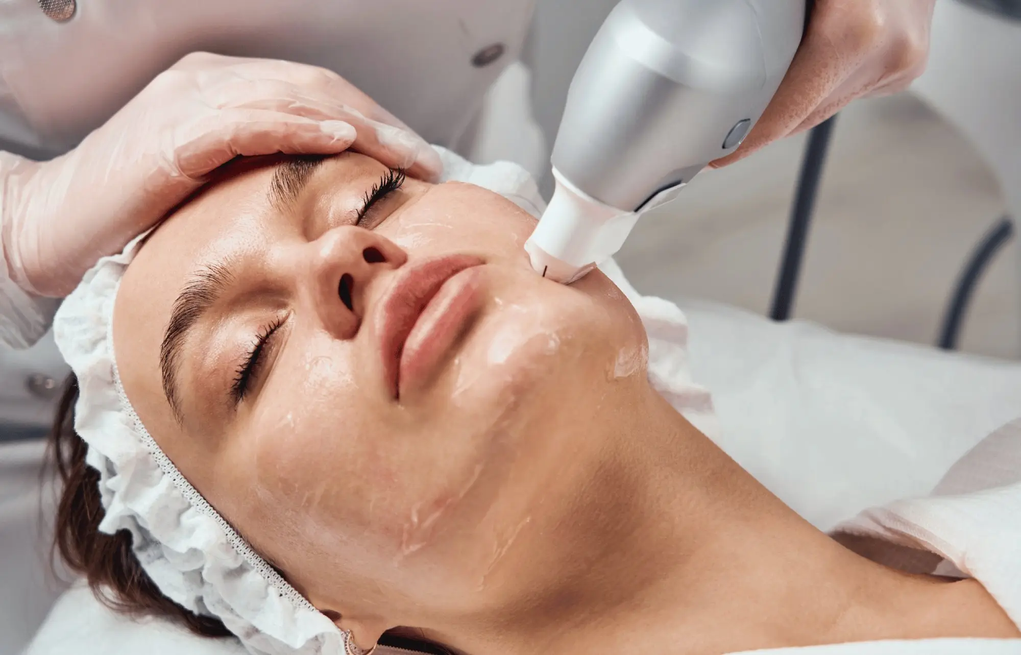 HIFU facial y corporal en Zenova Medic, Chiclayo