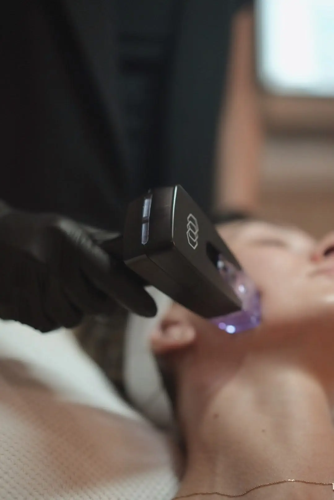 Morpheus facial: ¿Qué problema resuelve?