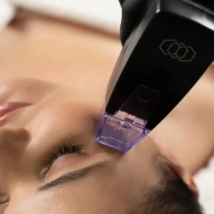 Morpheus facial en Zenova Medic, Chiclayo